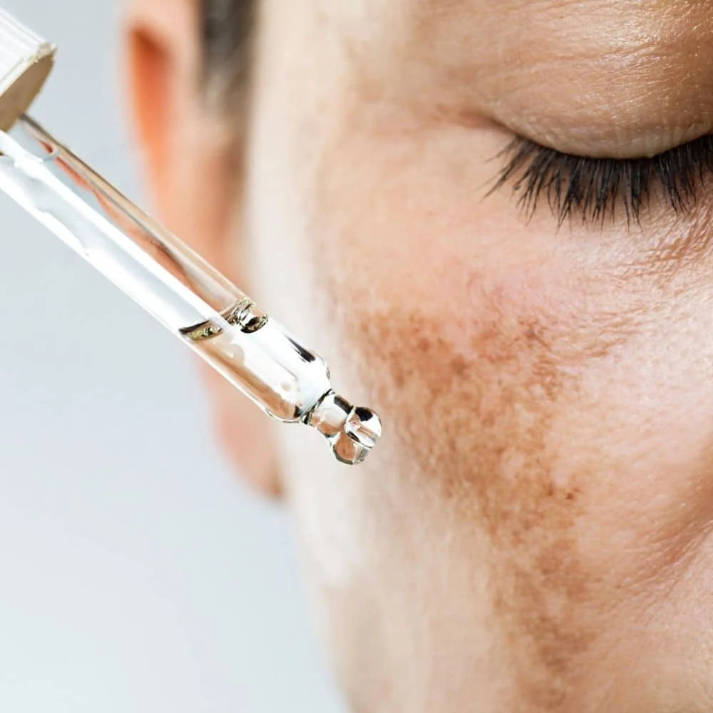 Comment traiter les taches brunes du visage efficacement au Maroc ?