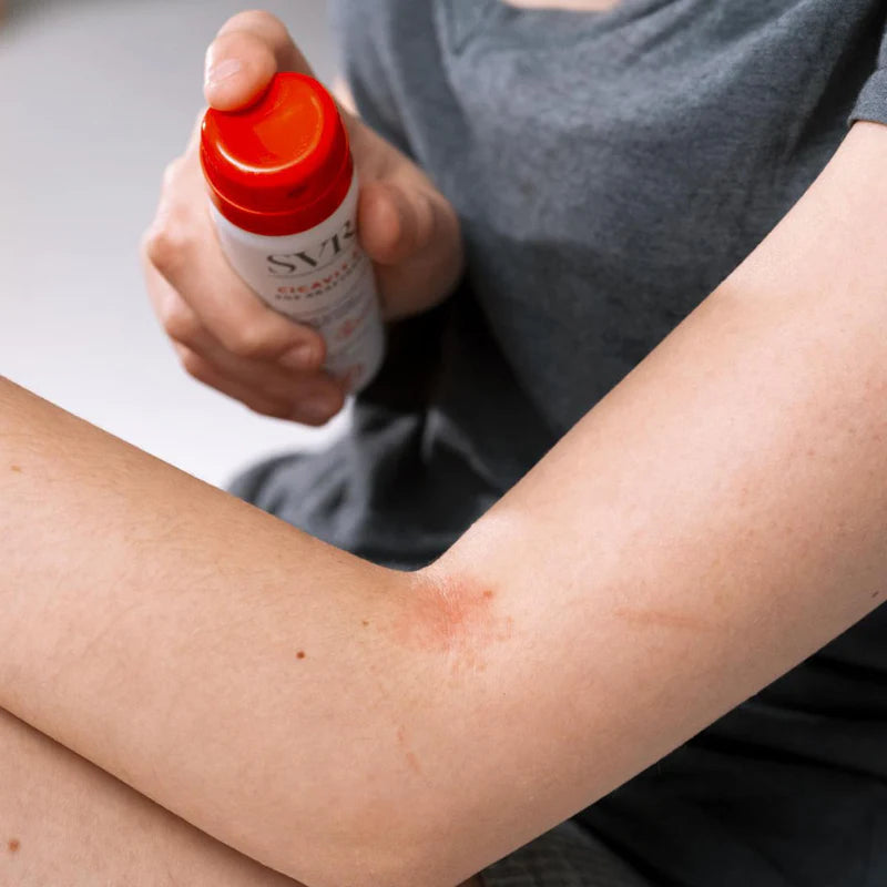 SVR Cicavit SOS Grattage 40 ml – Anti-démangeaisons