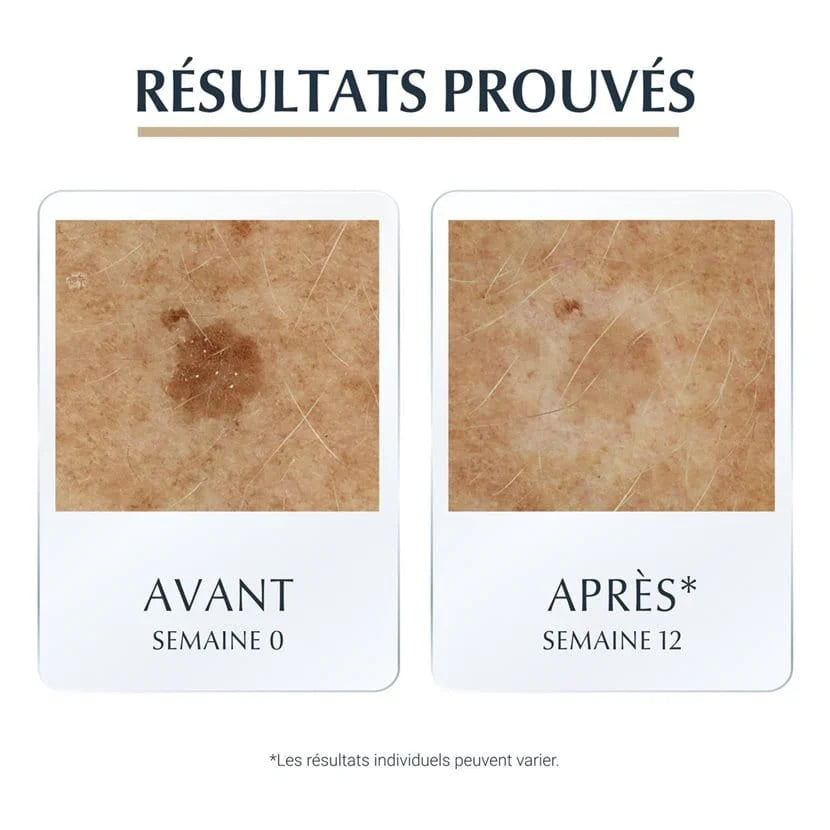 Eucerin Hyaluron-Filler + Elasticity 3D Sérum – Anti-Rides & Fermeté Peau