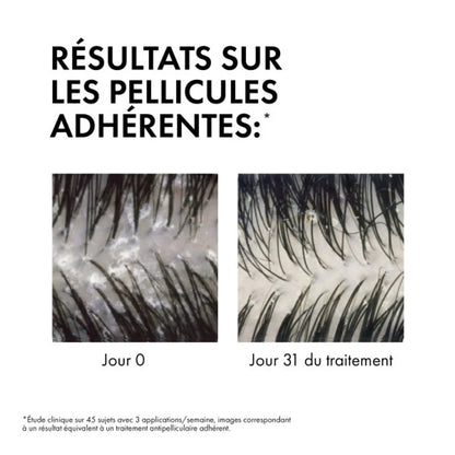 Vichy Dercos Shampooing Antipelliculaire Cheveux Secs 500ml Recharge