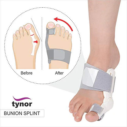 Tynor Attelle Hallux Valgus K14 – Bunion Splint pour Correction & Soulagement