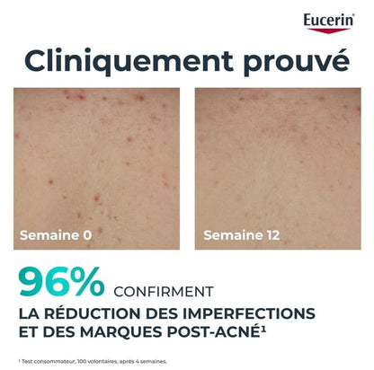 Eucerin DermoPurifyer Crème Corps Triple Action 200ml – Anti-Imperfections & Hydratation