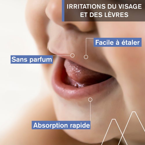 URIAGE BEBE SOIN PERI-ORAL 30ML