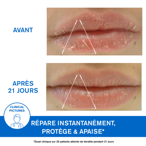 URIAGE BARIEDERM CICA LEVRES 15 ML