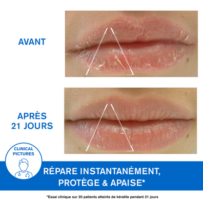 URIAGE BARIEDERM CICA LEVRES 15 ML