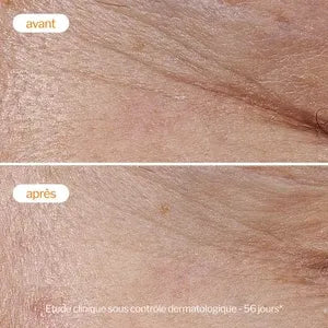 Novexpert Crème Légère à la Vitamine C 40ml | Hydratante & Éclat du Teint | Parahabib.ma