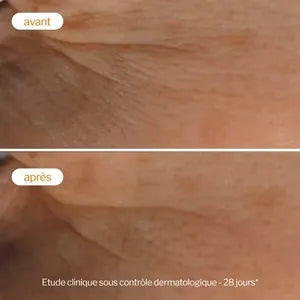 Novexpert Soin Peeling Eclat Vitamine C 30ml