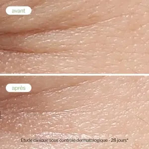 Novexpert Sérum Booster Whitening 30ml