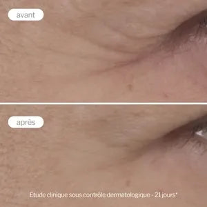 Novexpert Contour des Yeux Anti-Âge Expert 15ml
