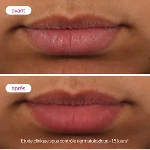 Novexpert Acide Hyaluronique Lip’Up Soin Volumateur Lèvres – 8 ml